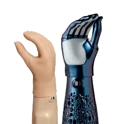 Prosthetic Hand